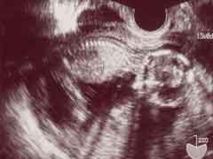 妊娠14週の胎児の様子