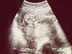 妊娠22週の胎児の様子