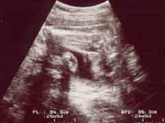 妊娠26週の胎児の様子