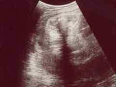 妊娠36週の胎児の様子