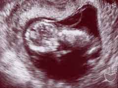妊娠12週の胎児の様子
