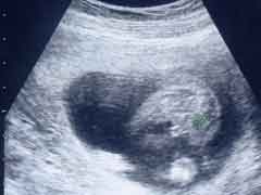 妊娠16週の胎児の様子