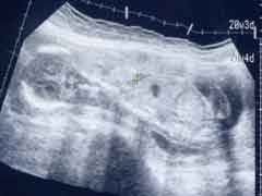 妊娠20週の胎児の様子