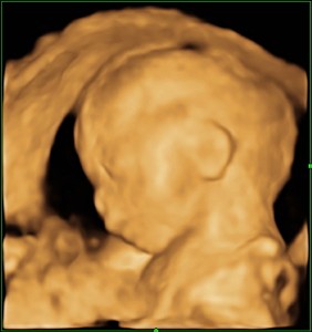 妊娠6ヶ月 妊娠20週目 超音波 4D 3D 写真