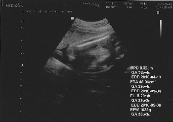 妊娠8ヶ月 妊娠29週目 超音波 胎児 写真