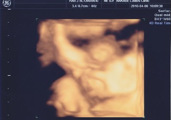 妊娠10ヶ月 妊娠36週目 臨月 4D 超音波 胎児 写真