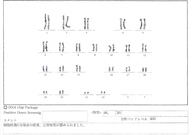 クリフム 絨毛検査 染色体G分染法結果