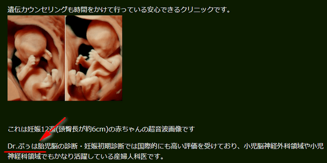 妊娠3ヶ月(妊娠11週目)：胎児ドッグ